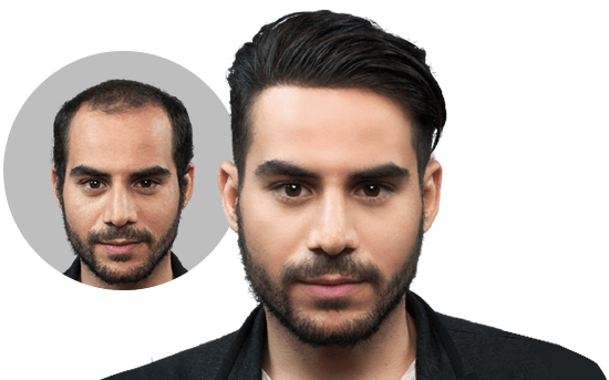 Hair Wellness Clinic Cosmetic hair Addition